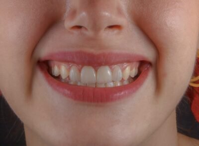 Dents