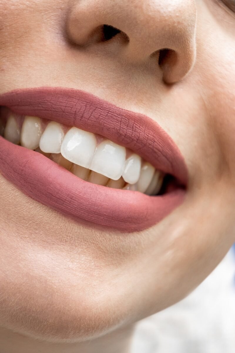 Dents